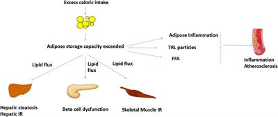 Obesity and Cardiovascular Disease: The Emerging Role of Inflammation